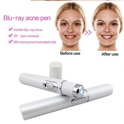 Stylo "Pure-Ray" – Thérapie Lumière Bleue Anti-Acné & Réparateur de Cicatrices