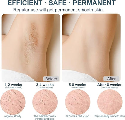 Épilateur Lumière Pulsée IPL Dépilation - Glace Refroidissement Sans Douleur & 1 Accessoire de Précision & 500000 Flashs pour Visage, Corps, le Maillot et les Aisselles, Laser Appareil Epilation